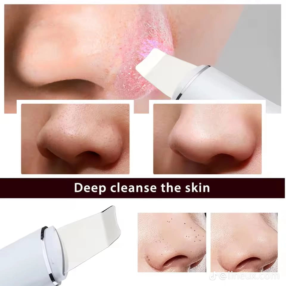 Limpiador Peeling Facial Ultrasónico